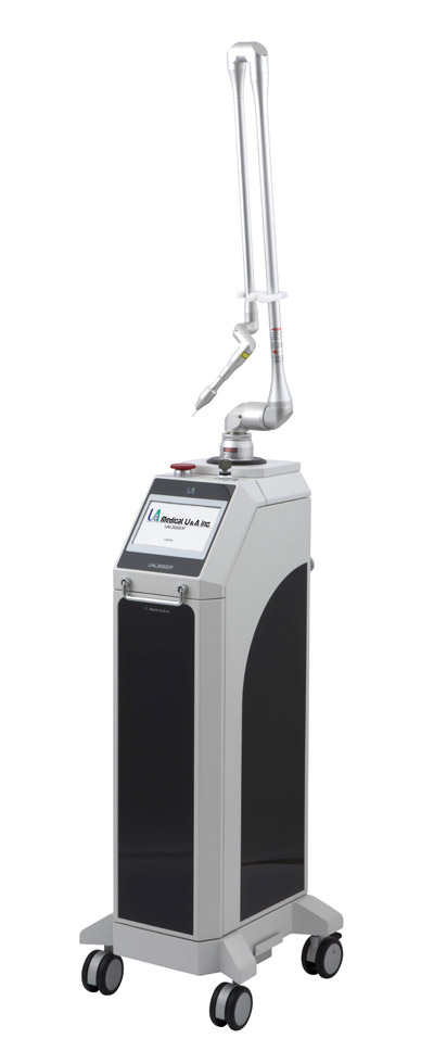 炭酸ガスレーザー