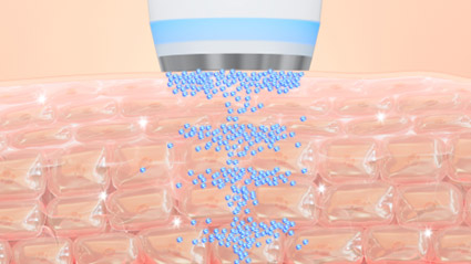 エレクトロポレーションとは